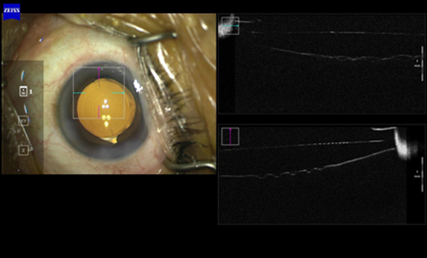 Advance Surgical Treatment